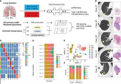 Accumulation of plasmacytoid dendritic cell is associated with a treatment response to DNA-damaging treatment and favorable prognosis in lung adenocarcinoma